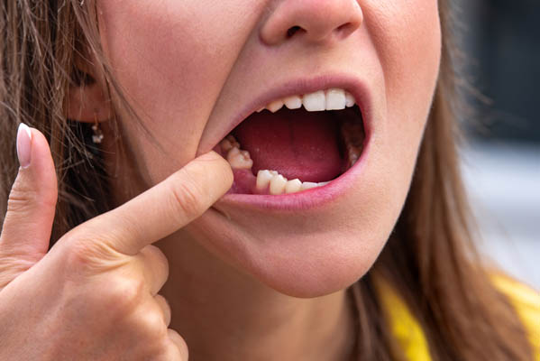 How Painful Can A Tooth Extraction Be?