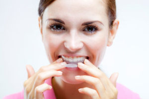 Clear Braces After Tooth Loss