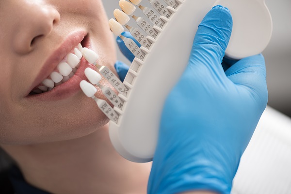 How Dental Crowns Can Give You A New Smile