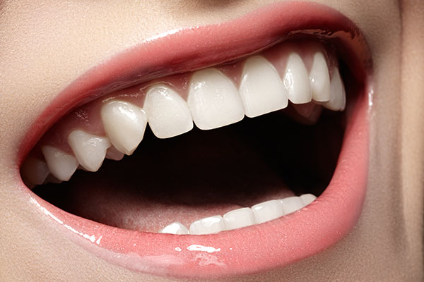 Dental Restorations