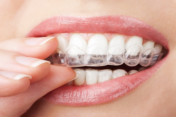 Invisalign Palos Verdes Estates, CA